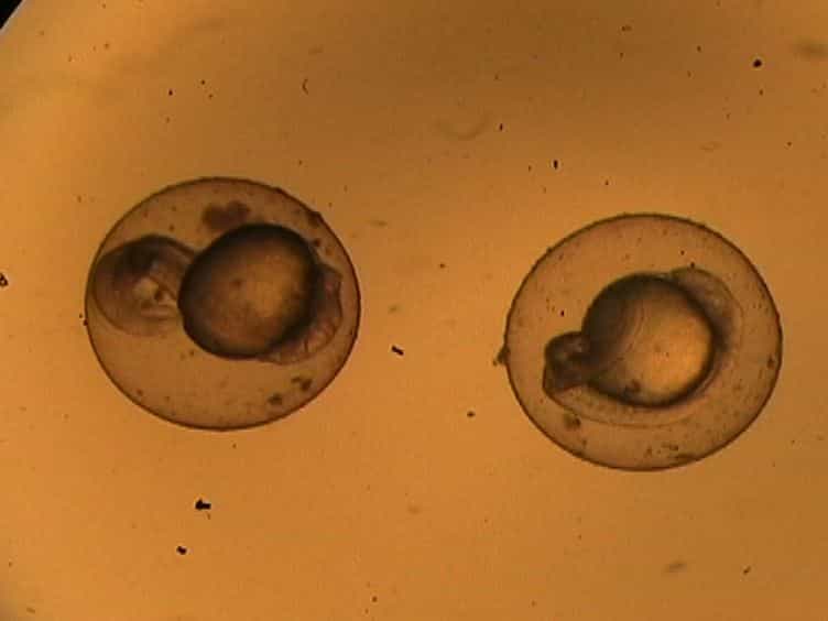 Metabolic Profile Analysis of Zebrafish Embryos