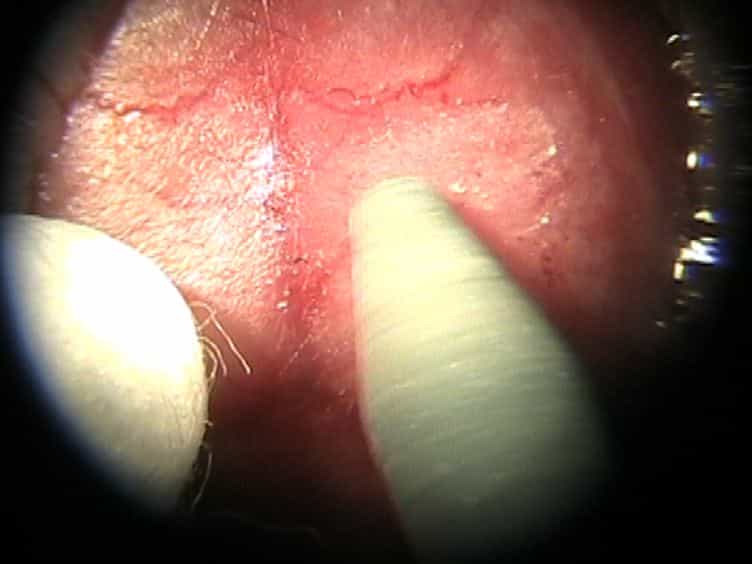 Thinned-skull Cortical Window Technique for In Vivo Optical Coherence Tomography Imaging