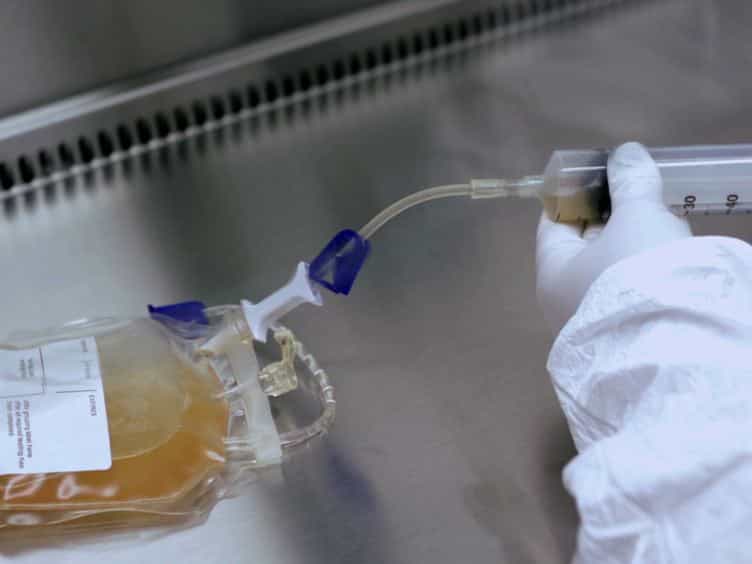 Preparation of Tumor Antigen-loaded Mature Dendritic Cells for Immunotherapy