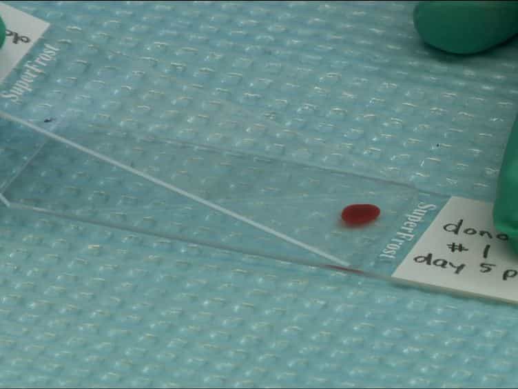 Isolation and Analysis of Brain-sequestered Leukocytes from Plasmodium berghei ANKA-infected Mice