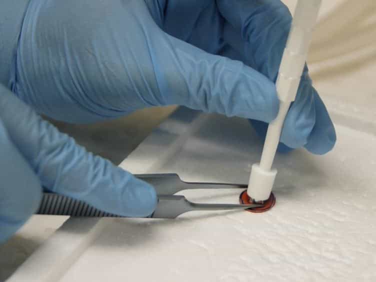 Murine Model of Wound Healing