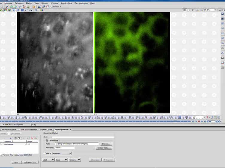 In vivo Measurement of the Mouse Pulmonary Endothelial Surface Layer