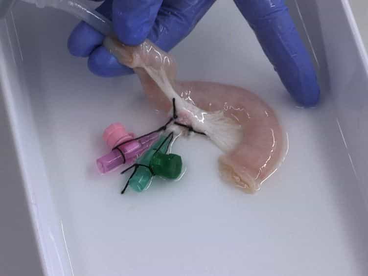 Tissue Engineering of a Human 3D in vitro Tumor Test System