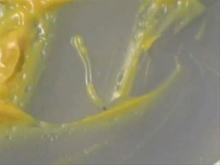 Optogenetic Perturbation of Neural Activity with Laser Illumination in Semi-intact <em>Drosophila</em> Larvae in Motion