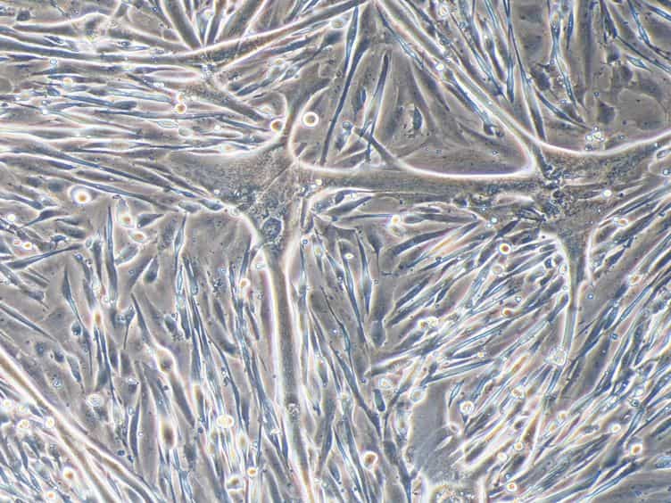 Transplantation of Induced Pluripotent Stem Cell-derived Mesoangioblast-like Myogenic Progenitors in Mouse Models of Muscle Regeneration