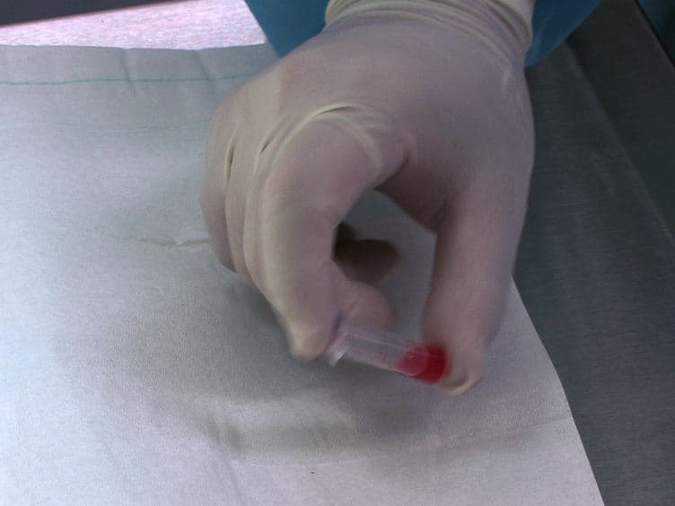 Parabiosis in Mice: A Detailed Protocol