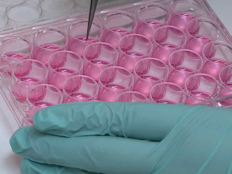 A Quantitative Cell Migration Assay for Murine Enteric Neural Progenitors