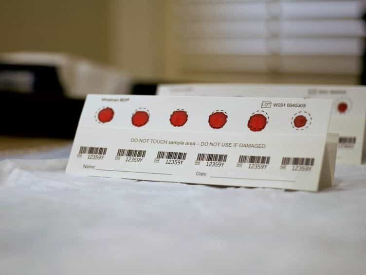 Dried Blood Spot Collection of Health Biomarkers to Maximize Participation in Population Studies
