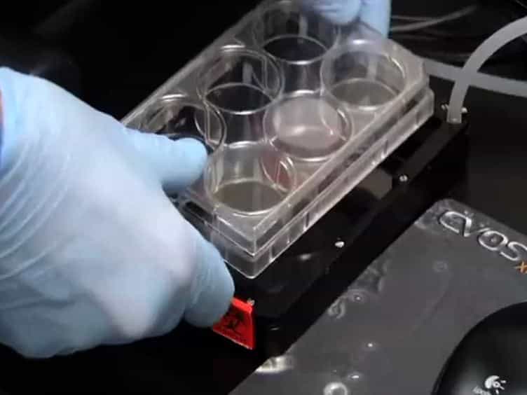 In vitro Cell Migration and Invasion Assays