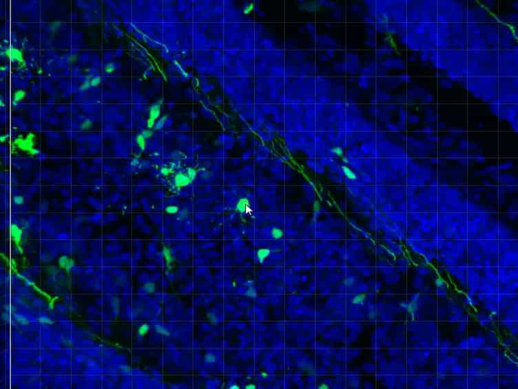 Genetic Manipulation of Cerebellar Granule Neurons In Vitro and In Vivo to Study Neuronal Morphology and Migration