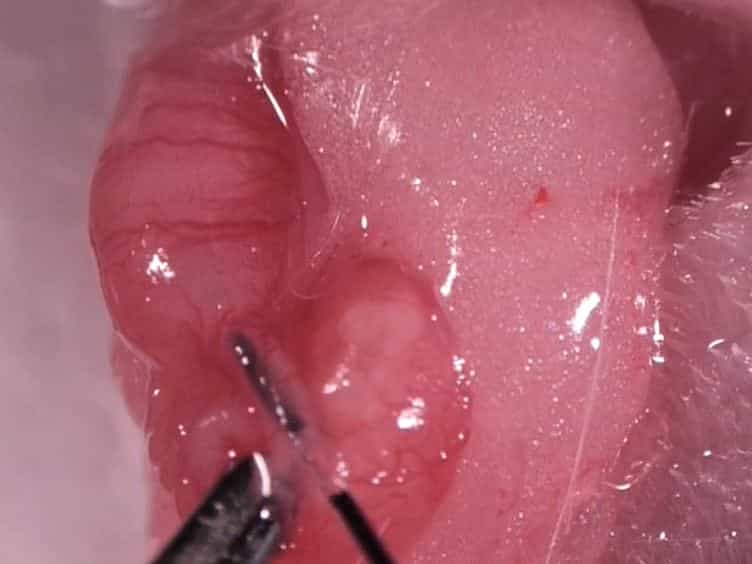 Utero-tubal Embryo Transfer and Vasectomy in the Mouse Model