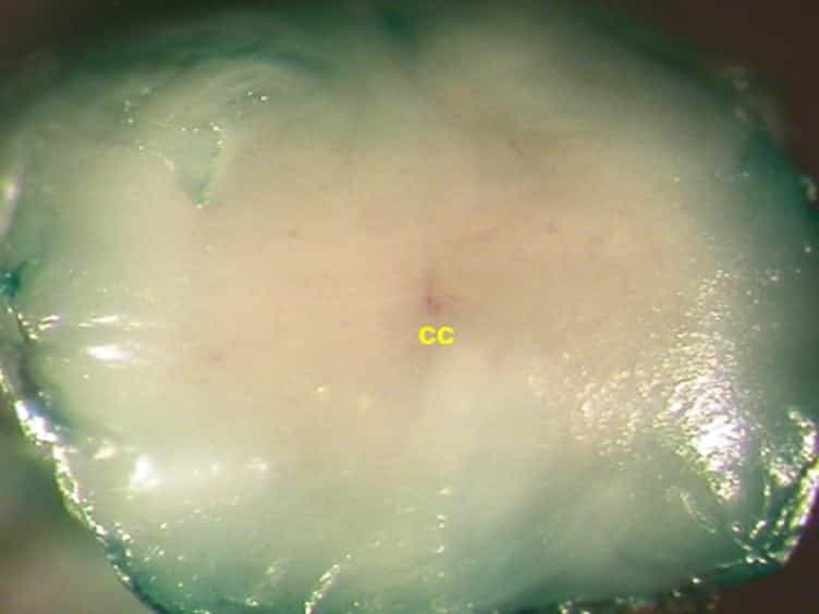 In Vivo SiRNA Transfection and Gene Knockdown in Spinal Cord via Rapid Noninvasive Lumbar Intrathecal Injections in Mice