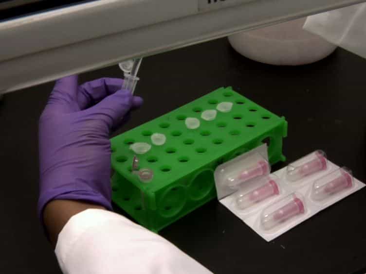 Profiling of Estrogen-regulated MicroRNAs in Breast Cancer Cells