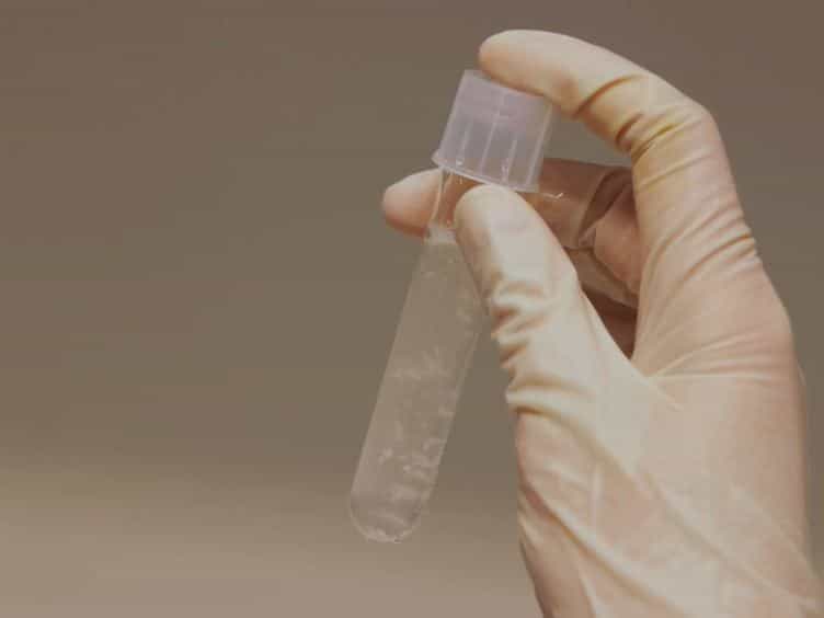Excitotoxic Stimulation of Brain Microslices as an In vitro Model of Stroke