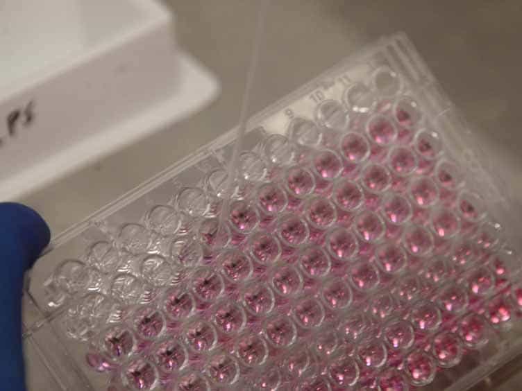 Using RNA-interference to Investigate the Innate Immune Response in Mouse Macrophages