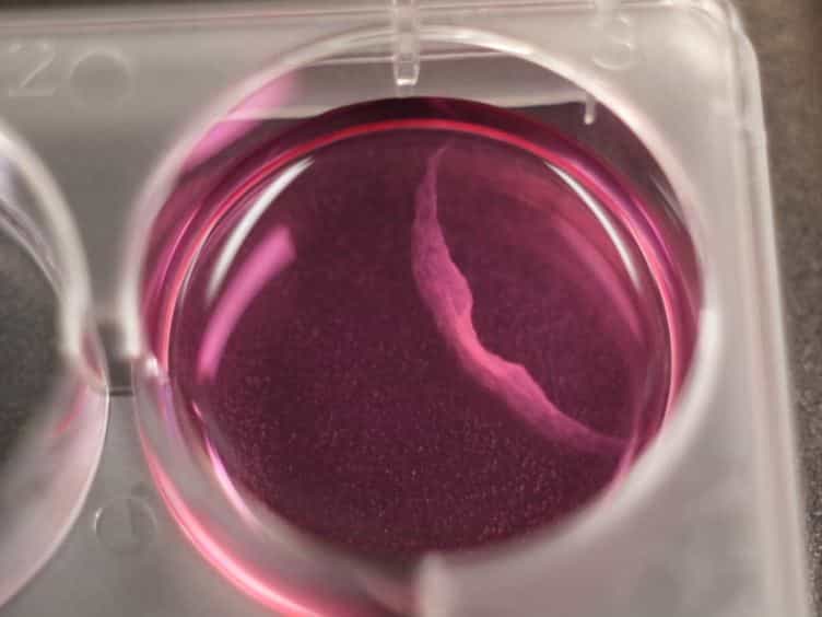 Tissue Engineering of Tumor Stromal Microenvironment with Application to Cancer Cell Invasion