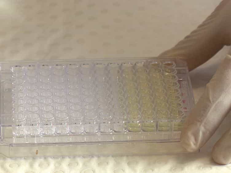 A Rapid and Specific Microplate Assay for the Determination of Intra- and Extracellular Ascorbate in Cultured Cells