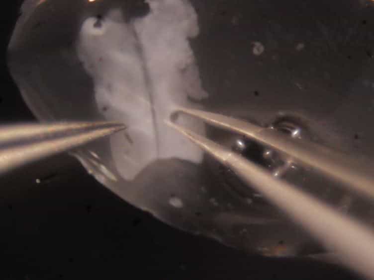 Mouse Hindbrain Ex Vivo Culture to Study Facial Branchiomotor Neuron Migration