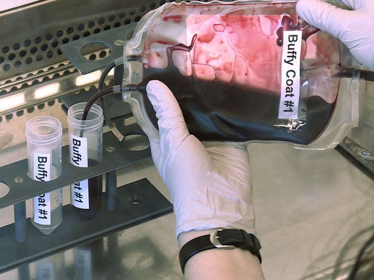 Isolation of Human Monocytes by Double Gradient Centrifugation and Their Differentiation to Macrophages in Teflon-coated Cell Culture Bags
