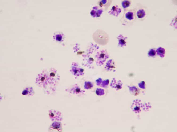 High Yield Purification of Plasmodium falciparum Merozoites For Use in Opsonizing Antibody Assays