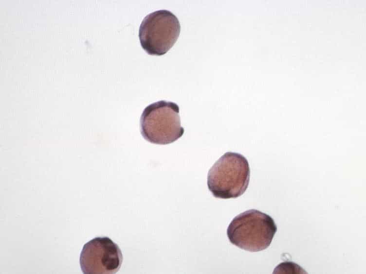 Flat Mount Preparation for Observation and Analysis of Zebrafish Embryo Specimens Stained by Whole Mount In situ Hybridization