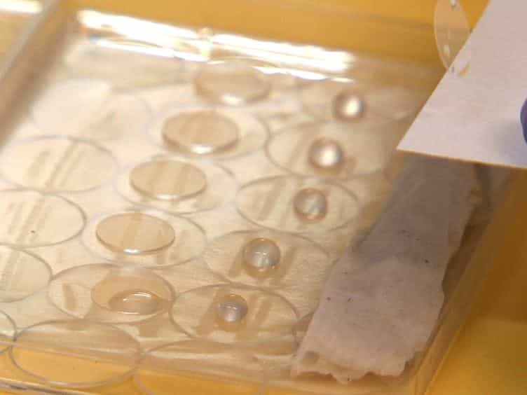 Analysis of the Epithelial Damage Produced by Entamoeba histolytica Infection