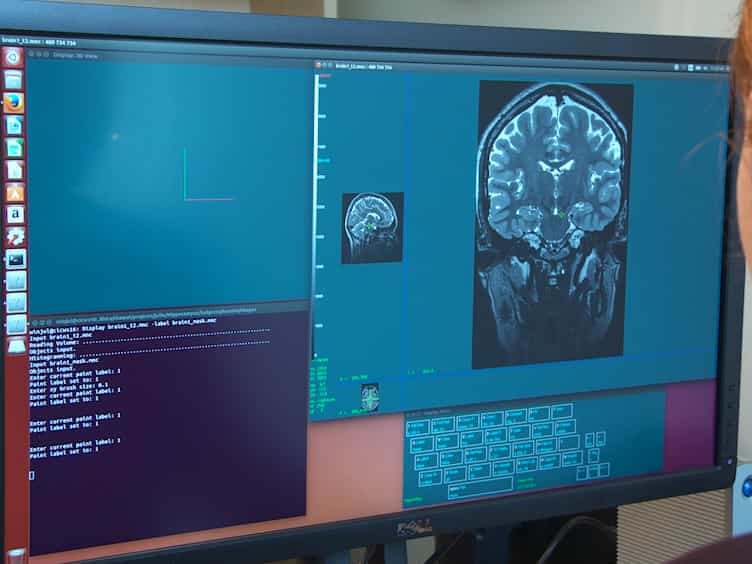 High-resolution In Vivo Manual Segmentation Protocol for Human Hippocampal Subfields Using 3T Magnetic Resonance Imaging