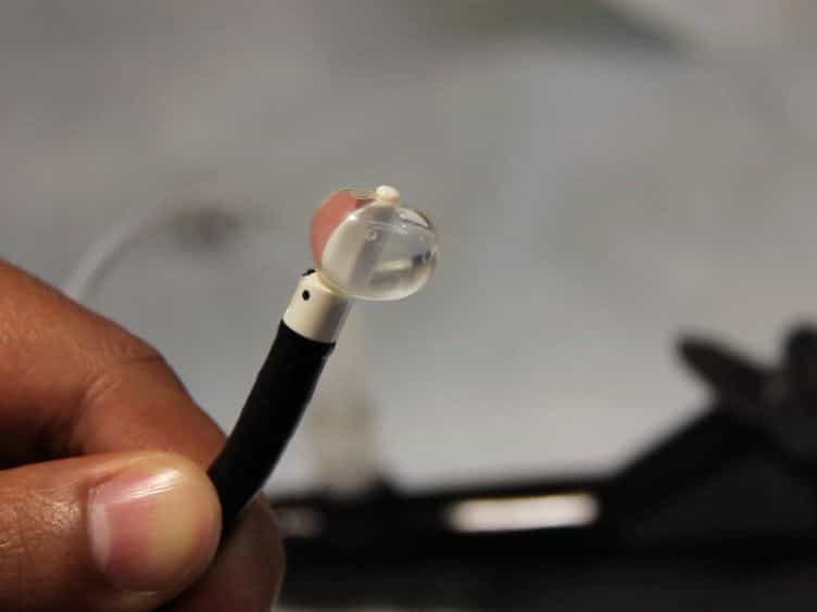 Substernal Thyroid Biopsy Using Endobronchial Ultrasound-guided Transbronchial Needle Aspiration