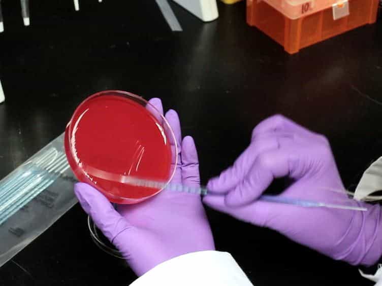 Using the Overlay Assay to Qualitatively Measure Bacterial Production of and Sensitivity to Pneumococcal Bacteriocins