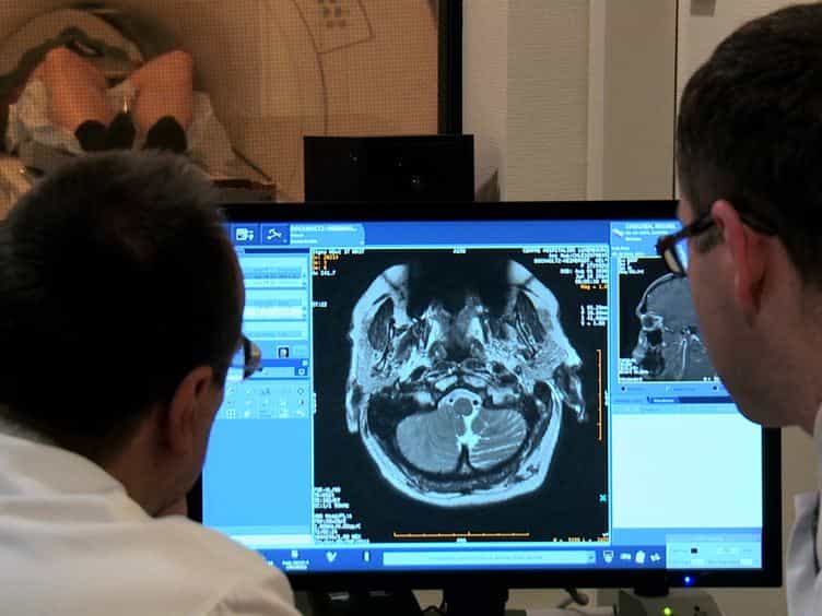 DTI of the Visual Pathway - White Matter Tracts and Cerebral Lesions