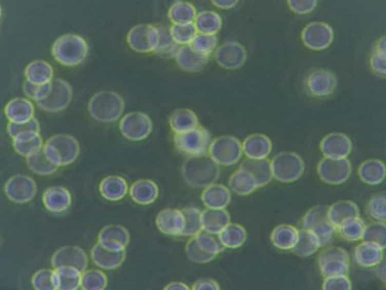 Highly Efficient Transfection of Human THP-1 Macrophages by Nucleofection