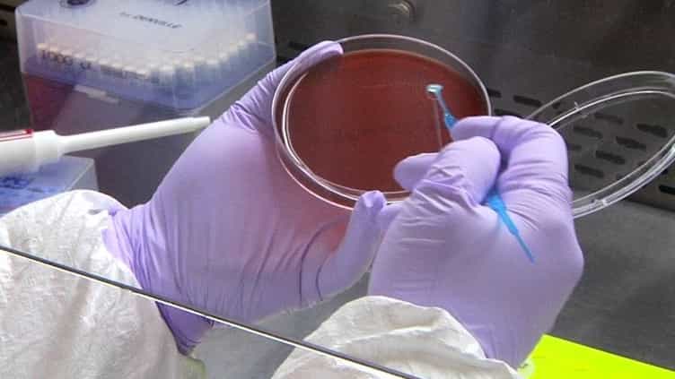 Pseudomonas aeruginosa Induced Lung Injury Model
