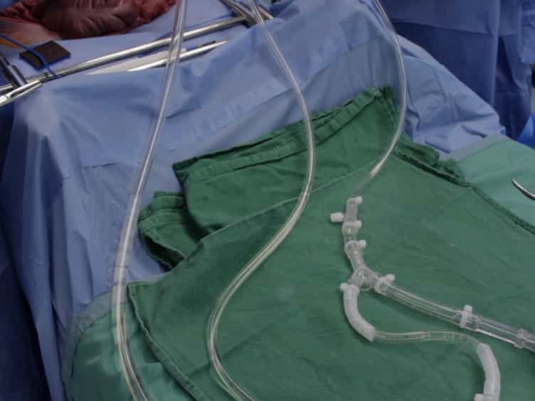 Technique of Porcine Liver Procurement and Orthotopic Transplantation using an Active Porto-Caval Shunt
