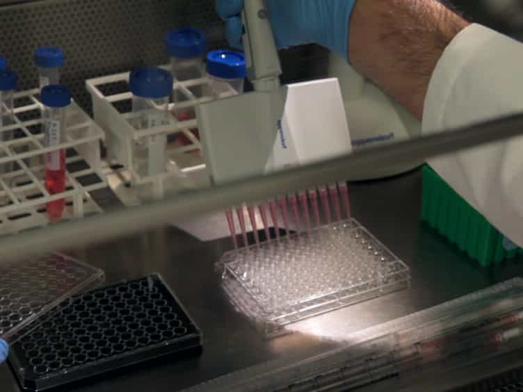 High Throughput Characterization of Adult Stem Cells Engineered for Delivery of Therapeutic Factors for Neuroprotective Strategies