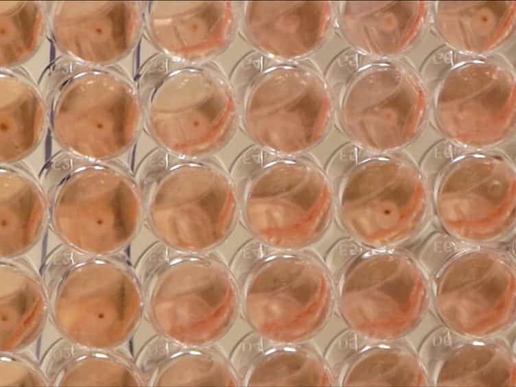 Generation of Human Alloantigen-specific T Cells from Peripheral Blood