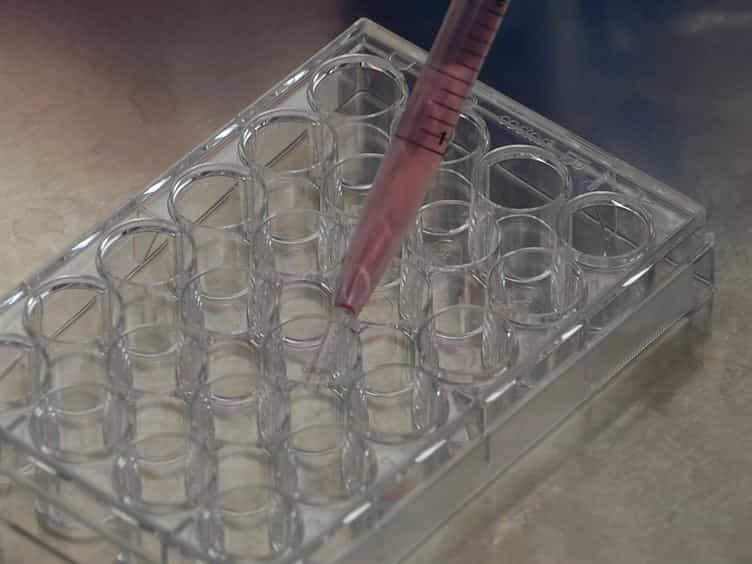 Direct Induction of Human Neural Stem Cells from Peripheral Blood Hematopoietic Progenitor Cells