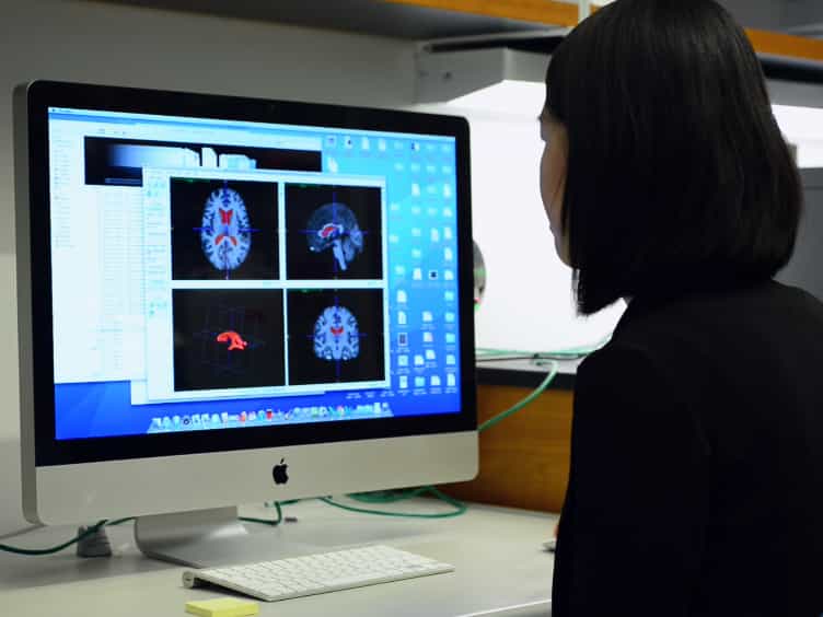 3D Modeling of the Lateral Ventricles and Histological Characterization of Periventricular Tissue in Humans and Mouse