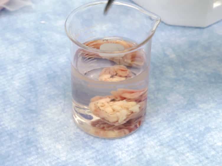 Establishment of Human Epithelial Enteroids and Colonoids from Whole Tissue and Biopsy