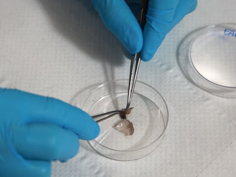 Preparation of Single-cell Suspensions for Cytofluorimetric Analysis from Different Mouse Skin Regions