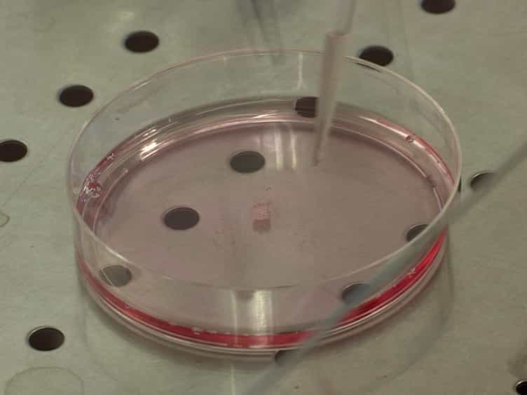 Establishment of a Human Multiple Myeloma Xenograft Model in the Chicken to Study Tumor Growth, Invasion and Angiogenesis