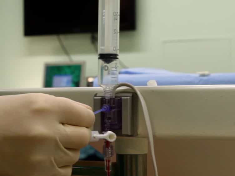 Ex Situ Normothermic Machine Perfusion of Donor Livers