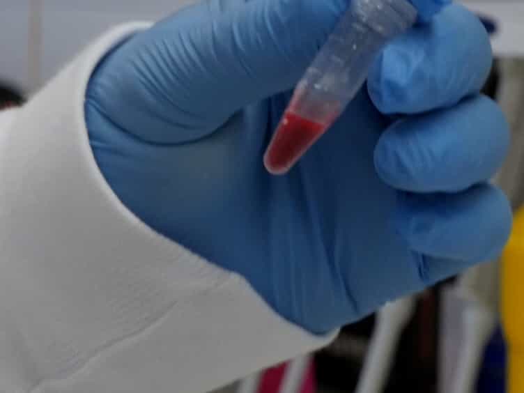 In Vivo Assessment of Rodent Plasmodium Parasitemia and Merozoite Invasion by Flow Cytometry
