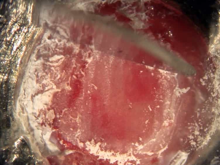 Rose Bengal Photothrombosis by Confocal Optical Imaging In Vivo: A Model of Single Vessel Stroke
