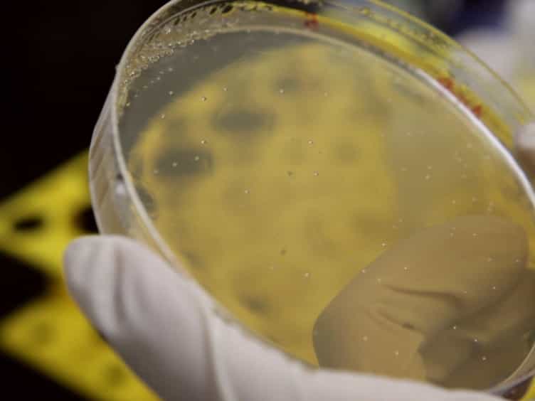 Design and Construction of Artificial Extracellular Matrix aECM Proteins from Escherichia coli for Skin Tissue Engineering