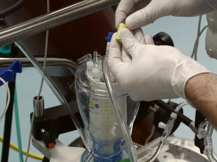 Normothermic Ex Vivo Kidney Perfusion for the Preservation of Kidney Grafts prior to Transplantation