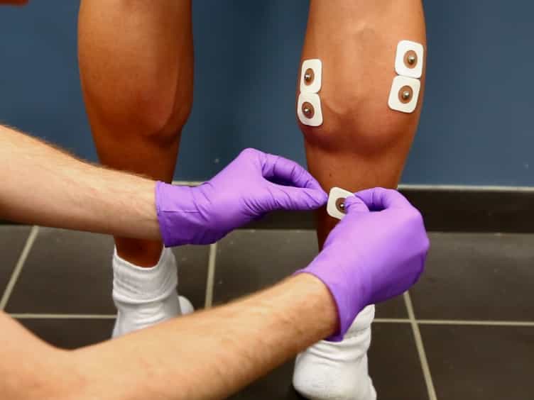 Assessment of Neuromuscular Function Using Percutaneous Electrical Nerve Stimulation