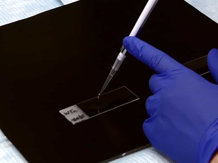 Surface Spreading and Immunostaining of Yeast Chromosomes
