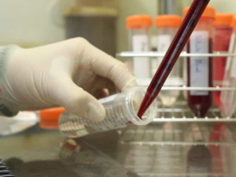 Assessment of the Immunomodulatory Properties of Human Mesenchymal Stem Cells (MSCs)