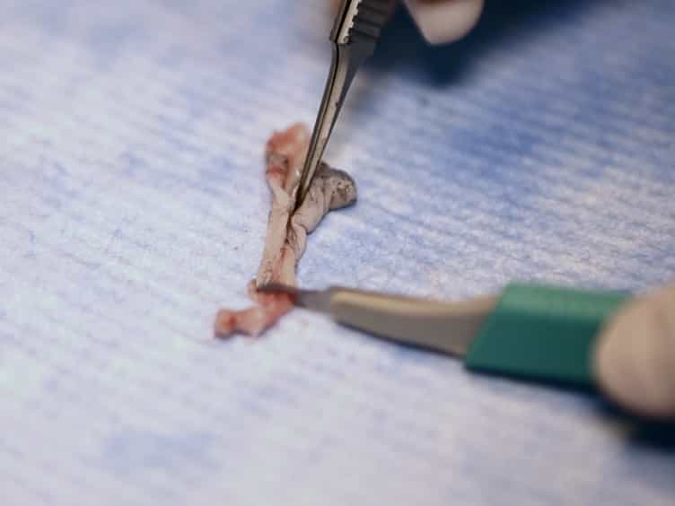 Murine Dermal Fibroblast Isolation by FACS