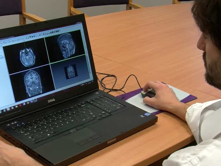 A Pipeline for 3D Multimodality Image Integration and Computer-assisted Planning in Epilepsy Surgery
